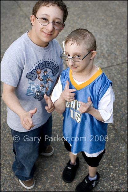 Primordial Dwarfism Portraits Gary Parker Photography San Jose Silicon Valley And San