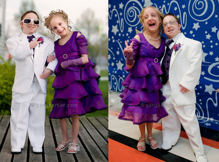 Hannah Kritzeck with Brad Jordan. Primordial Dwarfism, dressed for Brad's senior prom in 2009. Brad is 3'2.5"/35 lbs while Hannah is 3'3"/30 lbs.