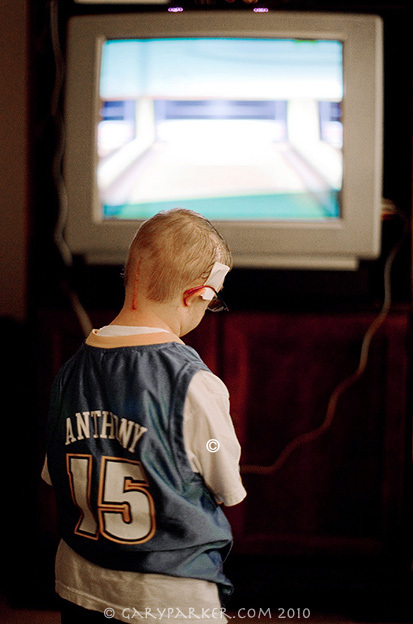 Brad plays Wii after the 2nd of 3 successful brain surgeries performed at Stanford Lucille Packard's Children's Hospital by renowned neurosurgeon Dr Gary Steinberg, a world authority on operating on the brains of Primordial Dwarfs.  With medical advancements, Dr Steinberg believes, "Primordial Dwarfs can now lead full lives."