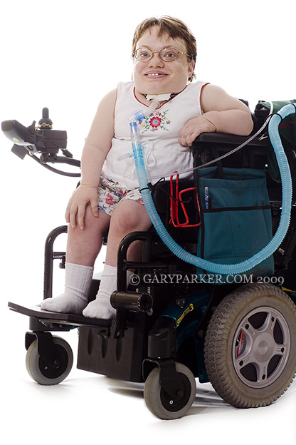 Danette Baker, has a rare type of dwarfism called Morquio Syndrome